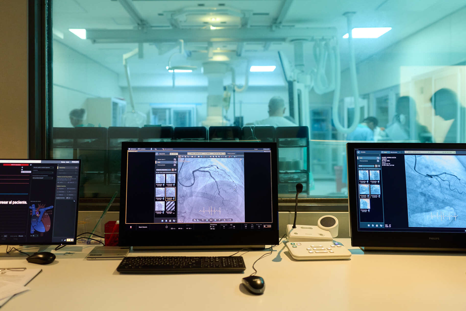 Sala de monitoreo de intervencionismo cardiovascular con visualización de imágenes angiográficas en tiempo real