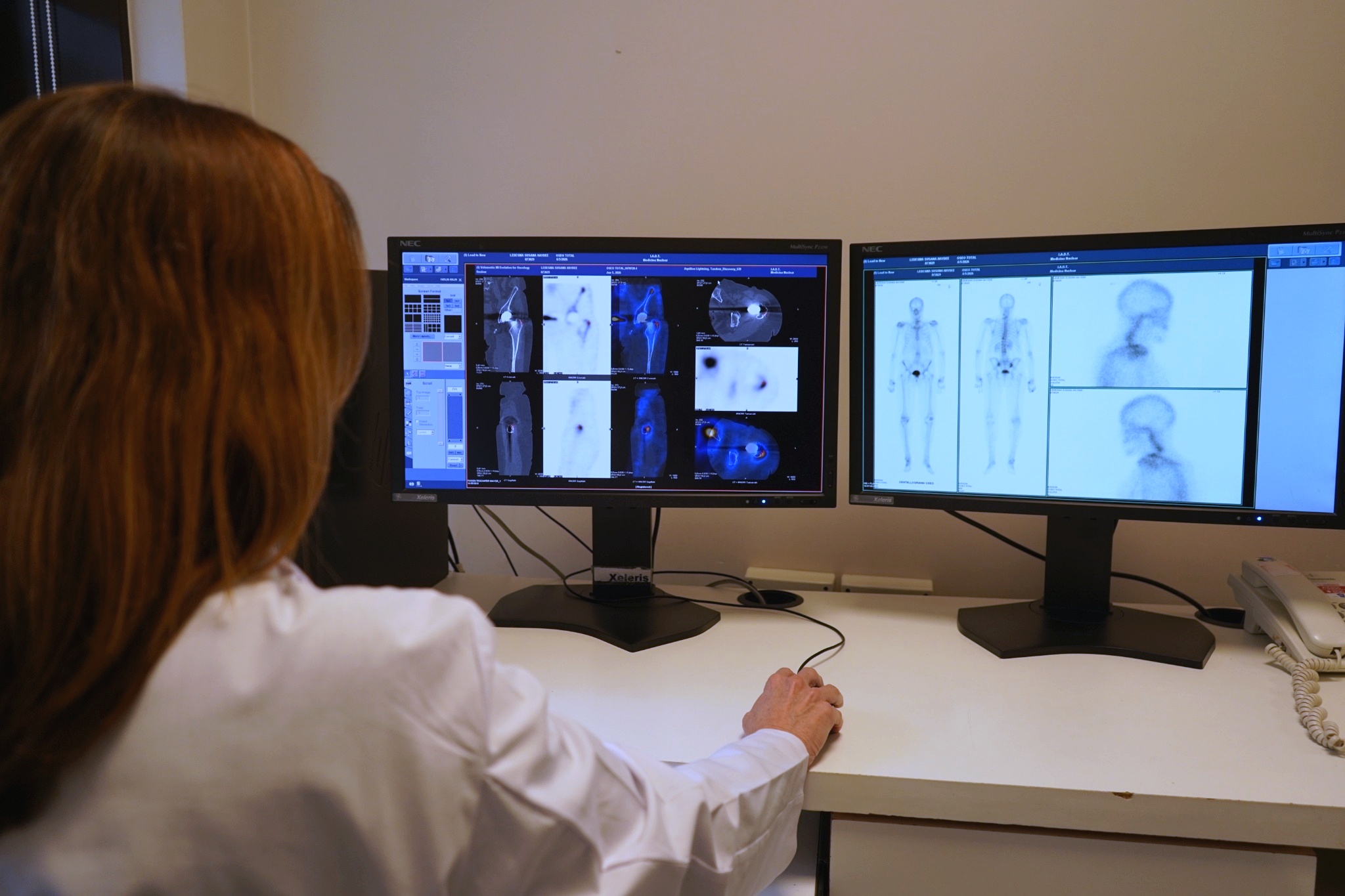 Médico especialista analizando imágenes obtenidas mediante estudios SPECT/CT en estación de trabajo avanzada.
